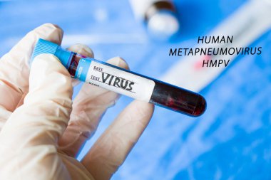 İnsan Metapneumovirüs, laboratuvarda HMPV virüsü testi