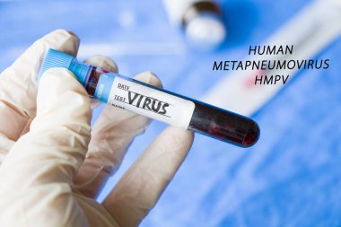 Human Metapneumovirus, HMPV virus test in lab clipart