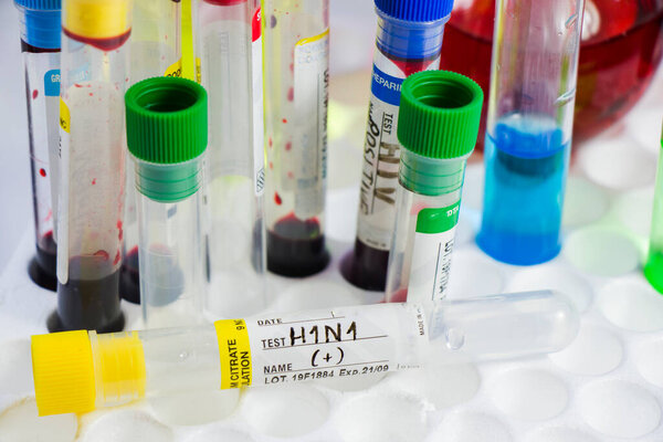 Метапневмовирус человека, анализ вируса HMPV в лаборатории