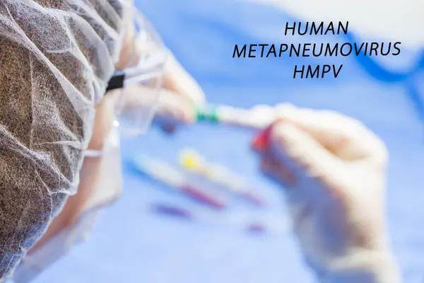 İnsan Metapneumovirüs, laboratuvarda HMPV virüsü testi