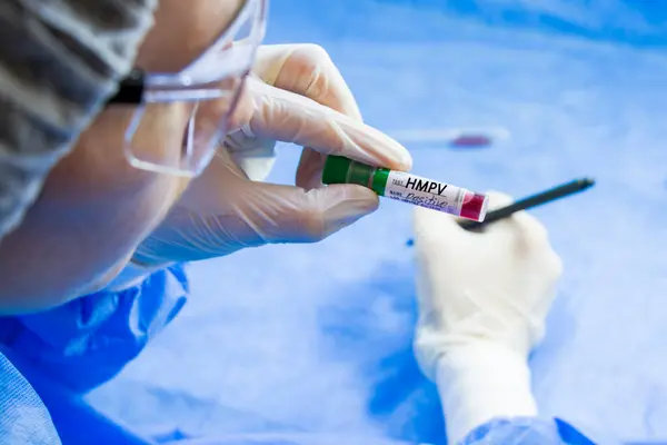 İnsan Metapneumovirüs, laboratuvarda HMPV virüsü testi