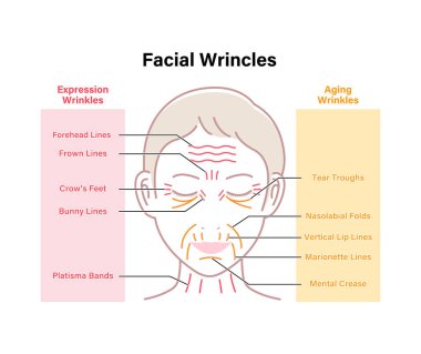 İfade kırışıklıkları ve yaşlanan kırışıklıklar (kadın yüzü) vektör çizimi 