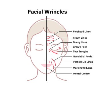 Facial wrinkles ( female face ) vector illustration clipart