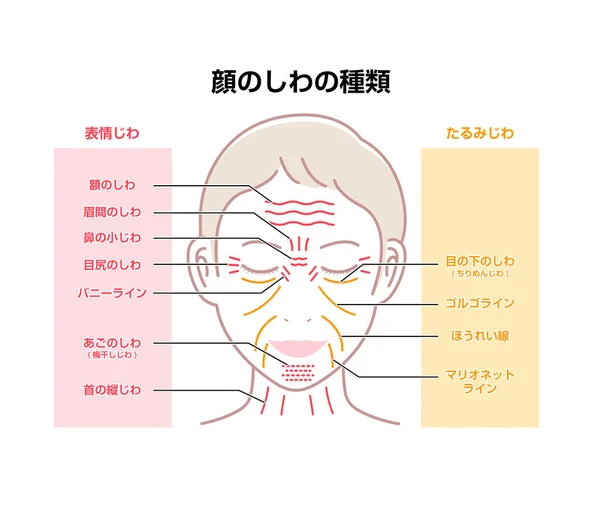表情しわと老化しわ 女性の顔 ベクトルイラスト 日本語 — ストックベクタ