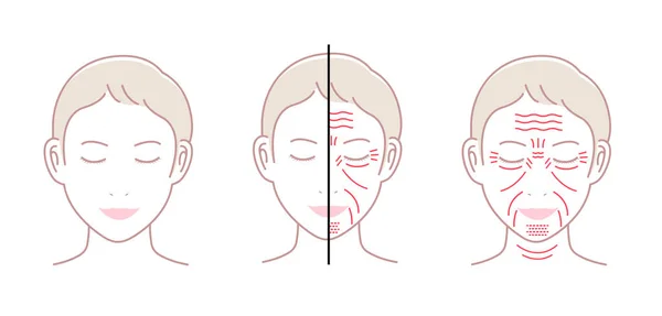 Conjunto Ilustración Vectores Arrugas Faciales Cara Femenina Sin Texto — Vector de stock