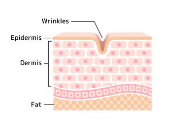 Kırışık cildin çapraz kesiti çizimi