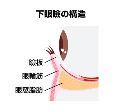 Düşük göz kapağı yapı vektörü çizimi