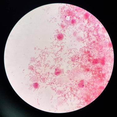 Modern Gram Neagtive Bacilli slaytta.