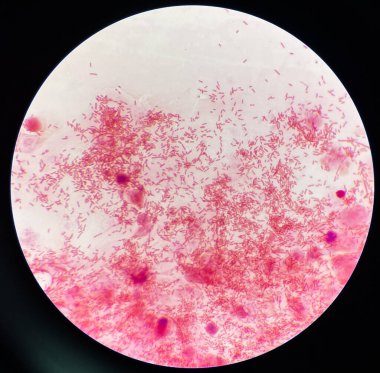 Modern Gram Neagtive Bacilli slaytta.