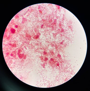 Modern Gram Neagtive Bacilli slaytta.