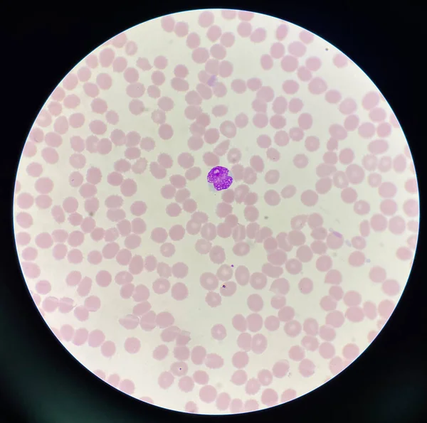 Rbc背景の未熟白血球 — ストック写真