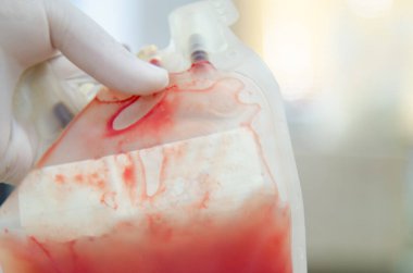Blood bag with scientis in laboratory.