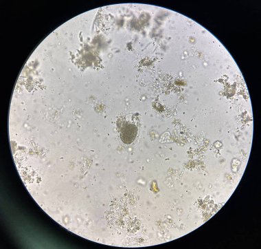 Hookworm egg human parasite in stool examination test find microscope 40x.
