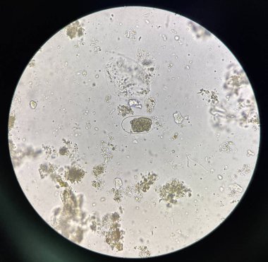 Hookworm egg human parasite in stool examination test find microscope 40x.
