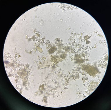 Hookworm egg human parasite in stool examination test find microscope 40x.