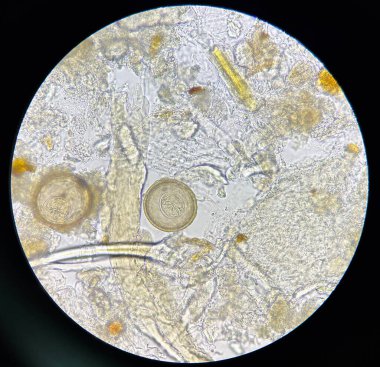 hymenolepis diminuta egg human parasite in stool examination test find microscope 40x.