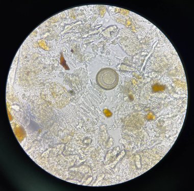 hymenolepis diminuta egg human parasite in stool examination test find microscope 40x.