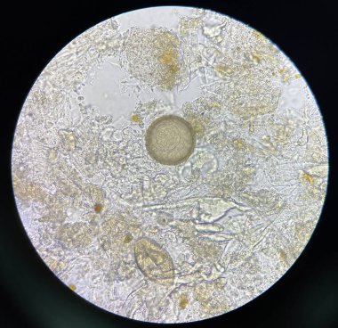 hymenolepis diminuta egg human parasite in stool examination test find microscope 40x.