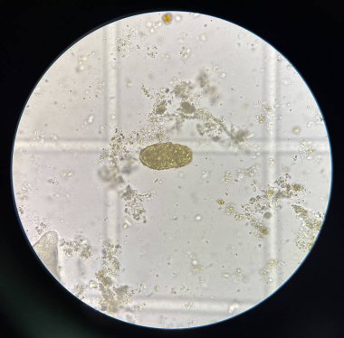 human parasite in stool examination test.