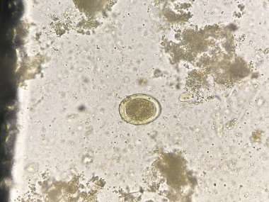 Ascaris lumbricoides  egg human parasite in stool examination.