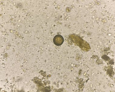 Teania egg human parasite in stool examination.