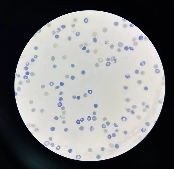 Ретикулоциты Эритроциты Которые Развиваются Известны Незрелые Эритроциты — стоковое фото