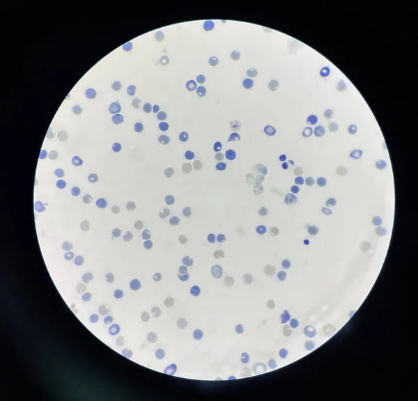 Δικτυοκύτταρα Είναι Ερυθρά Αιμοσφαίρια Που Αναπτύσσονται Ακόμα Είναι Επίσης Γνωστά — Φωτογραφία Αρχείου