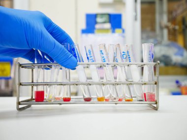 Mavi eldivenli bir bilim adamı laboratuvarda kan gruplandırma testi yapıyor..