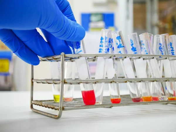 Вчений Синьою Рукавичкою Тестує Групування Крові Лабораторії — стокове фото