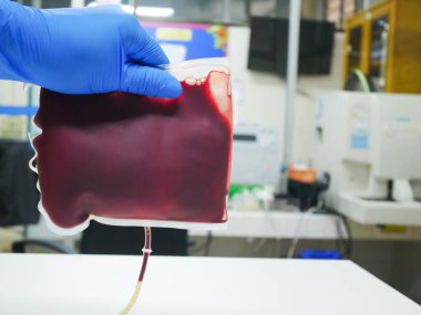 Kan bankası laboratuvarında kan torbası. Tıp bilimi..