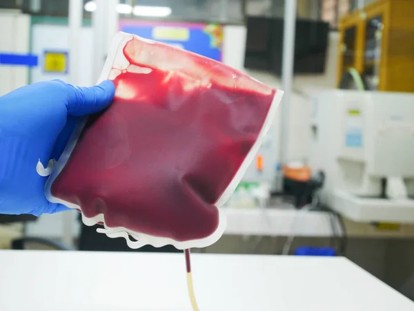 Bloedzak Bloedbank Labo Medische Wetenschap — Stockfoto