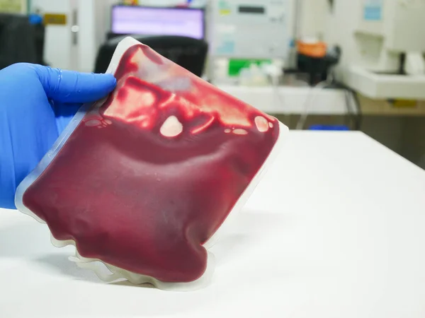Blood Bag Bloodbank Laboratory Medical Science — Stock Photo, Image