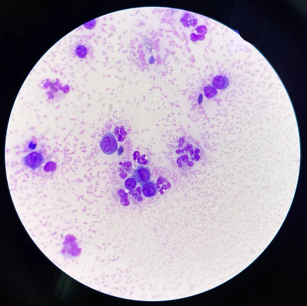 Sinoviyal Sıvı Altyapısal Hücrelerde Orta Dereceli Nörofil — Stok fotoğraf