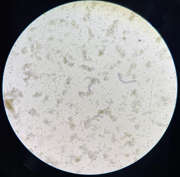 Личинка Strongyloides Stercolari Перемещается Свежем Стуле Лаборатории — стоковое фото