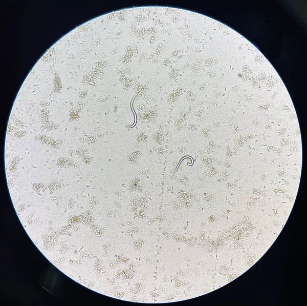 Larva Strongyloides Stercolari Moviéndose Heces Frescas Laboratorio —  Fotos de Stock