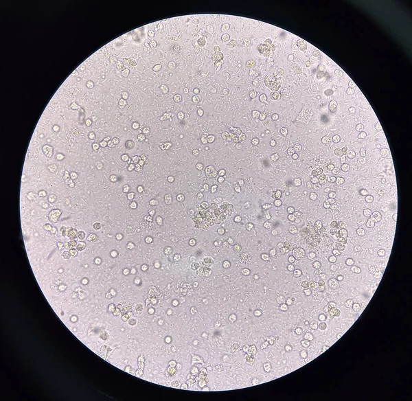 Mikroorganismus Bílé Krvinky Moči — Stock fotografie