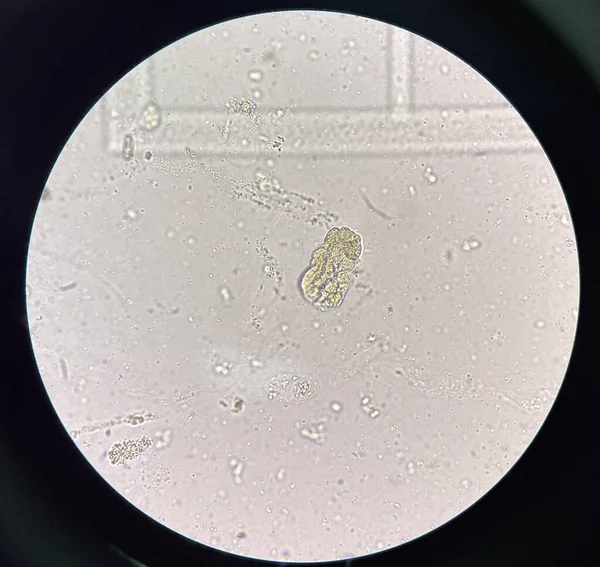 Placa Fundido Urina Fresca Encontrar Com Microscópio — Fotografia de Stock