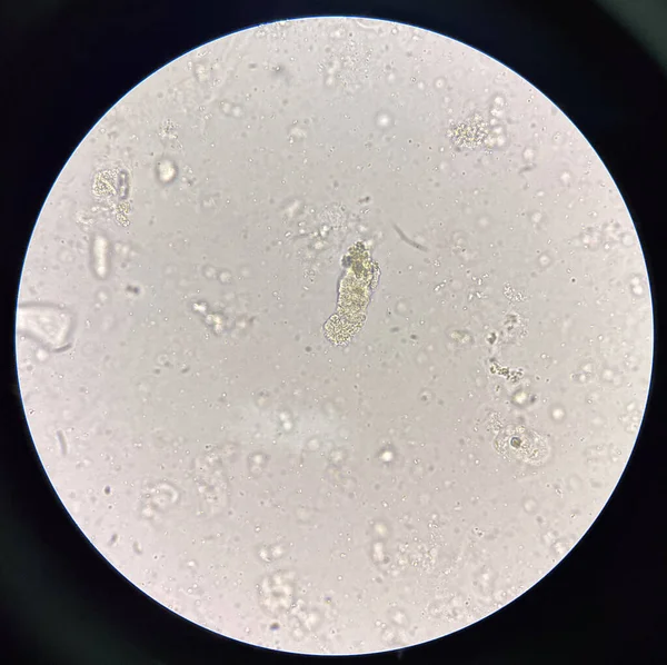 Kartong Gjuten Färsk Urin Fynd Med Mikroskop — Stockfoto