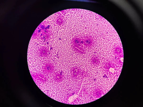 Белые Клетки Крови Синовиальной Жидкости Тела — стоковое фото