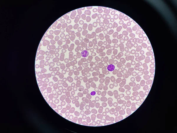 具有Rbc背景的正常白血球基底中性粒细胞淋巴细胞淋巴细胞 — 图库照片