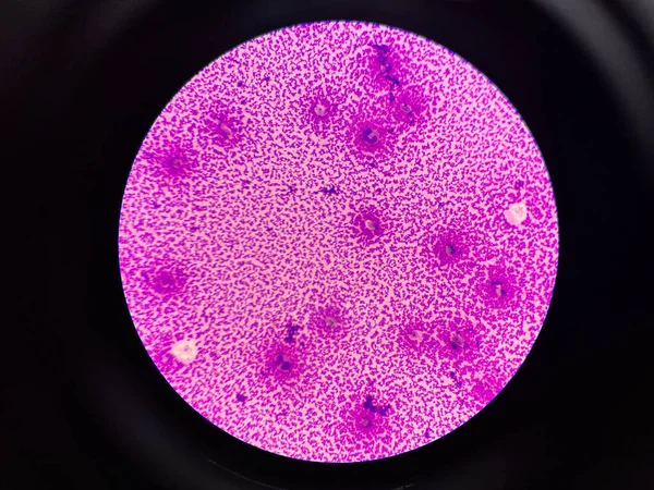 Fehérvérsejtek Synovialis Folyadékban — Stock Fotó
