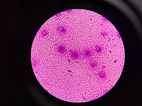 Белые Клетки Крови Синовиальной Жидкости Тела — стоковое фото