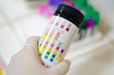 Laboratuvarda bilim adamıyla idrar bandı..