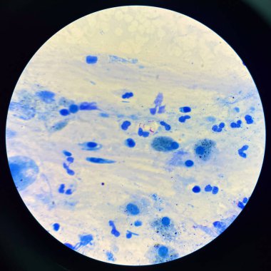 Merkezi Mycobacterium tüberküloz bakterisi orta dereceli kırmızı hücre.