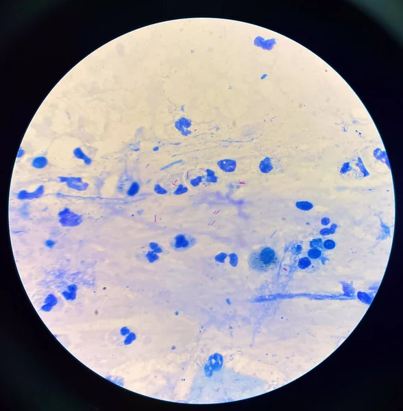 Células Vermelhas Moderadas Centro Mycobacterium Tuberculosis Bactérias — Fotografia de Stock