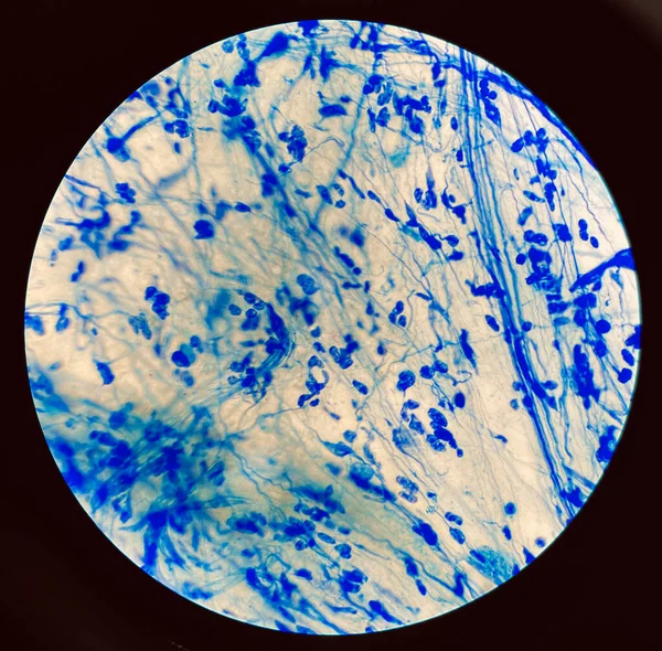 Mäßige Rote Zelle Auf Mycobacterium Tuberculosis Bakterien — Stockfoto