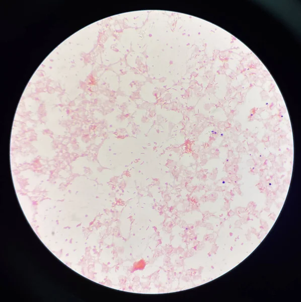 Rode Bloedcel Matige Gram Negatieve Bacillen Hemocultuur — Stockfoto