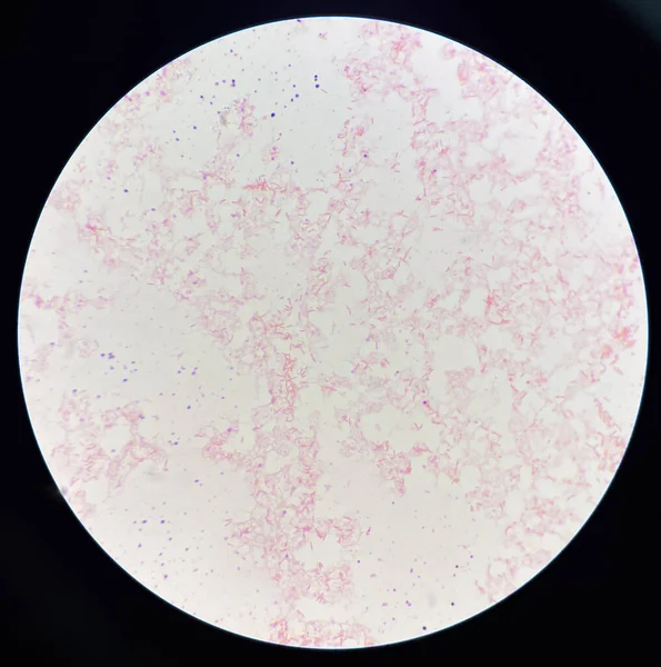血红蛋白培养中的中性粒细胞阴性杆菌 — 图库照片