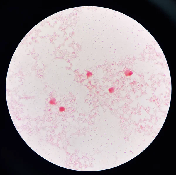 Červené Krvinky Střední Gram Negativní Bacily Hemokulturě — Stock fotografie