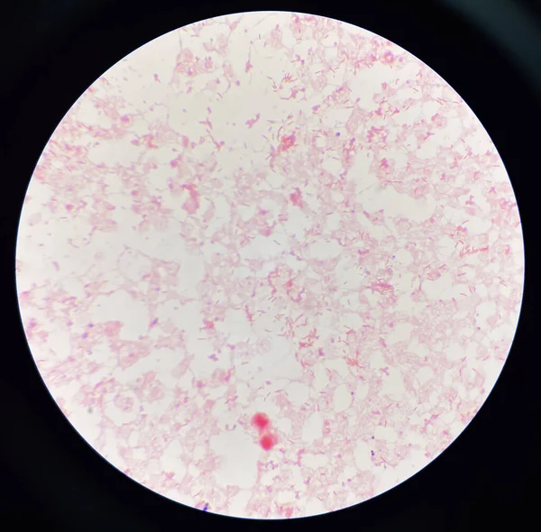 Czerwone Krwinki Umiarkowane Gram Ujemne Bacilli Hodowli Hemo — Zdjęcie stockowe